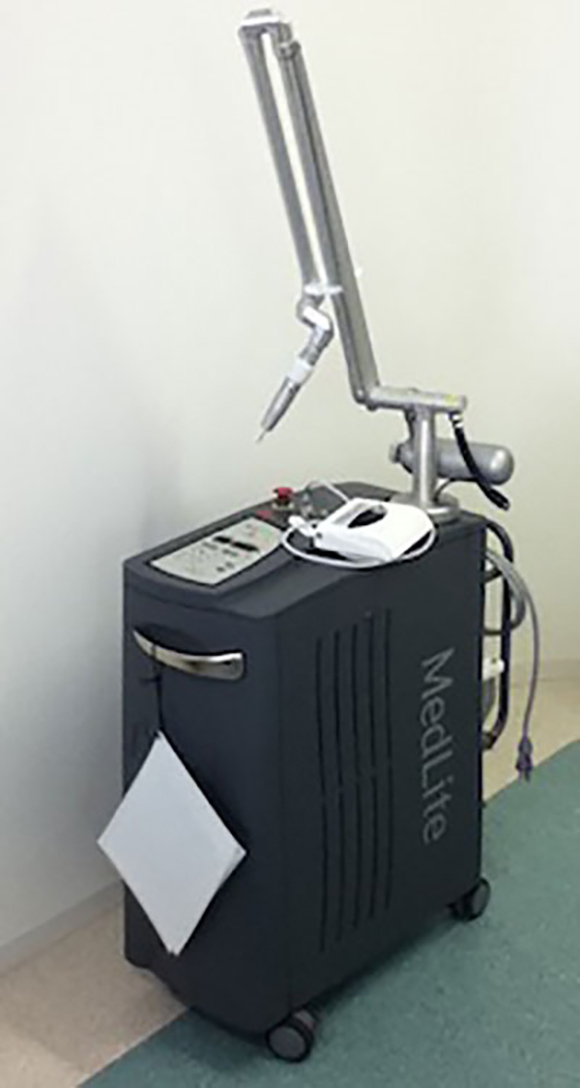 レーザートーニング