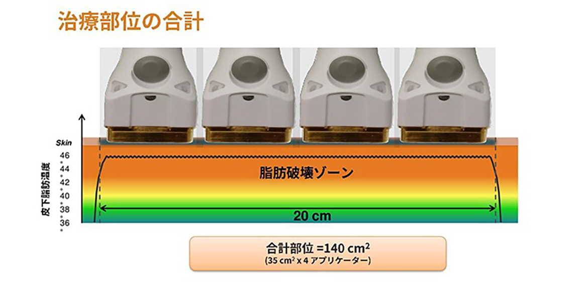 治療部位の合計